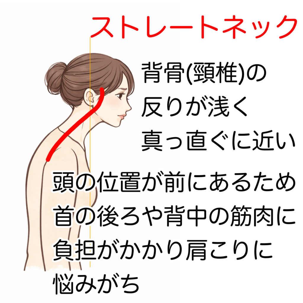 福山市,姿勢矯正,猫背,肩こり,頭痛,腰痛