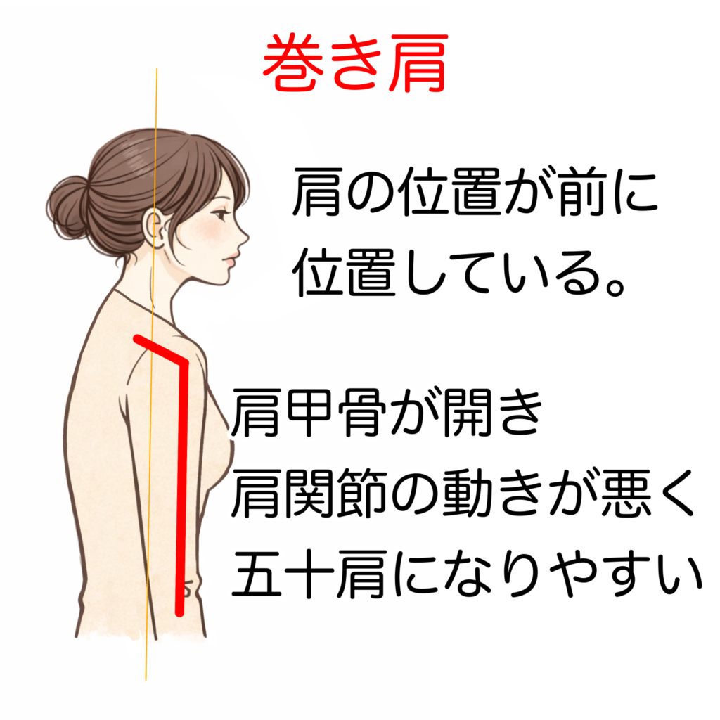 福山市,姿勢矯正,猫背,肩こり,頭痛,腰痛